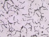 Vermicular graphite